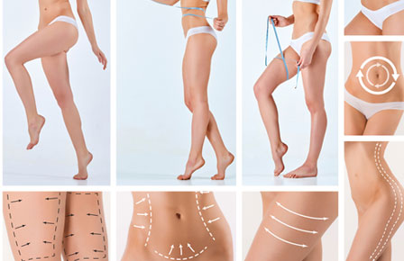 Liposuction Surgery - Power Air Assisted liposuction